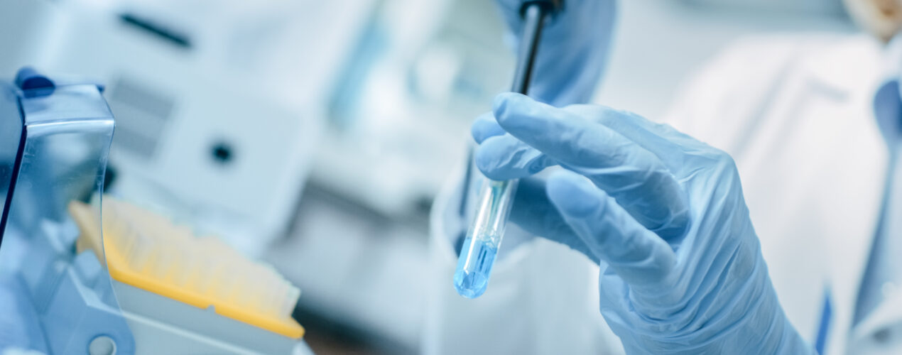 Close-up of the Hand in Glove Using Micro Pipette while Working with Test Tubes. People in Innovative Pharmaceutical Laboratory with Modern Medical Equipment for Genetics Research.